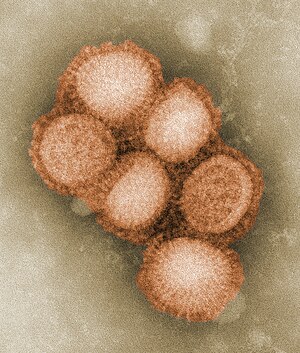 300px-CDC-11214-swine-flu.jpg